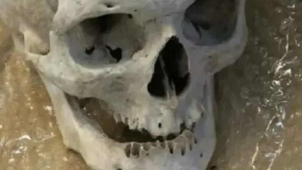 Detienen en Uganda a sospechoso tras el hallazgo de 17 cráneos humanos